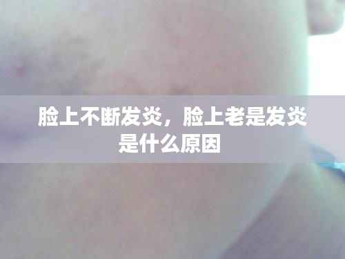 脸上不断发炎，脸上老是发炎是什么原因 
